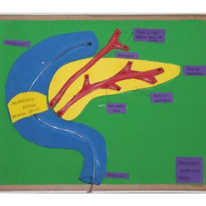 PANCREAS WORKING MODEL